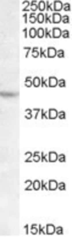 LHX2 Antibody, Novus Biologicals 0.1mg; Unlabeled:Antibodies, Polyclonal
