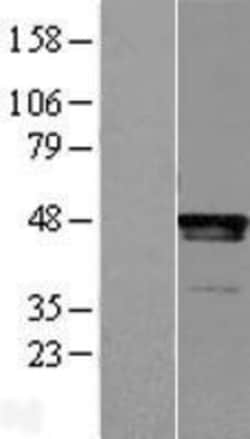 Novus Biologicals™ LHX2 Overexpression Lysate