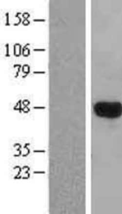 Novus Biologicals&trade;&nbsp;LHX3 Overexpression Lysate