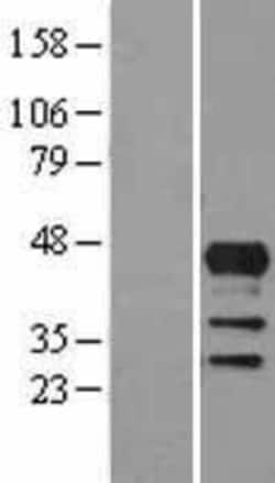 Novus Biologicals&trade;&nbsp;Lhx4 Overexpression Lysate