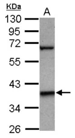 LHX5 Antibody, Novus Biologicals 0.1mL; Unlabeled:Antibodies, Polyclonal