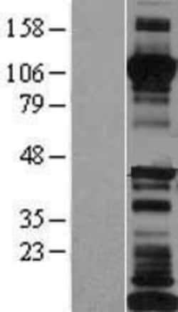 Novus Biologicals™ Cadherin-17 Overexpression Lysate