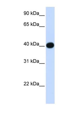 LIAS Antibody, Novus Biologicals:Antibodies:Primary Antibodies