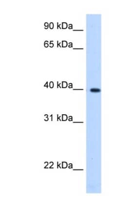 LIAS Antibody, Novus Biologicals:Antibodies:Primary Antibodies