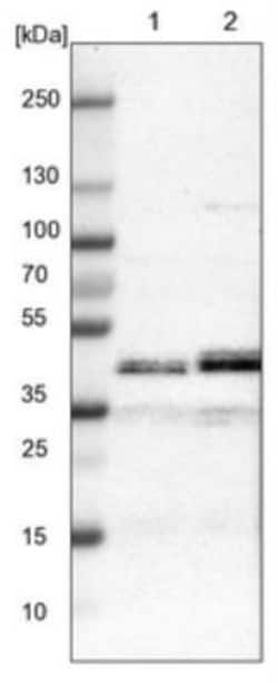 LIAS Antibody, Novus Biologicals 0.1mL; Unlabeled:Antibodies, Polyclonal