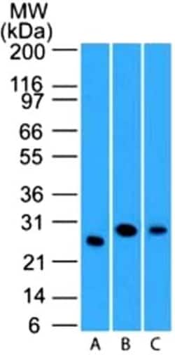 LIF Antibody (39N7D10) - BSA Free, Novus Biologicals 0.025 mg | Buy Online | Novus Biologicals | Fisher Scientific