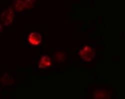 LIF Antibody - BSA Free, Novus Biologicals 0.1mg; Unlabeled:Antibodies,