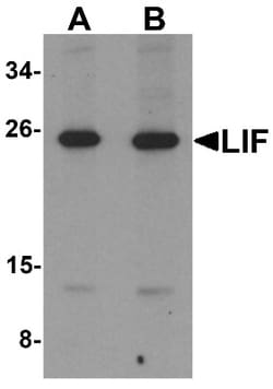 LIF Antibody - BSA Free, Novus Biologicals 0.1mg; Unlabeled:Antibodies,