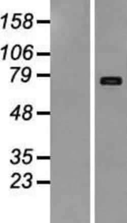 Novus Biologicals&trade;&nbsp;LIFR alpha Overexpression Lysate