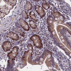 DNA Ligase I Antibody, Novus Biologicals:Antibodies:Primary Antibodies