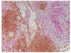 Novus Biologicals Lightning-Link (R) HRP Antibody Labeling Kit