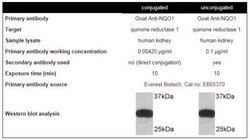 Novus Biologicals Lightning-Link (R) HRP Antibody Labeling Kit 5 mg | Buy Online | Novus Biologicals&trade; | Fisher Scientific
