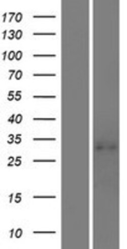 Novus Biologicals&trade;&nbsp;ILT11/LILRA5 Overexpression Lysate