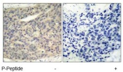 LIM Kinase 1, p Thr508 Antibody, Novus Biologicals 0.05 mL | Buy Online | Novus Biologicals | Fisher Scientific