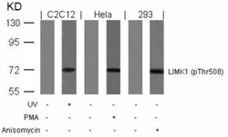 LIM Kinase 1, p Thr508 Antibody, Novus Biologicals 0.05 mL | Buy Online | Novus Biologicals | Fisher Scientific