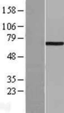 Novus Biologicals&trade;&nbsp;LIM Kinase 1 Overexpression Lysate