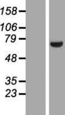 Novus Biologicals&trade;&nbsp;LIM kinase 2 Overexpression Lysate