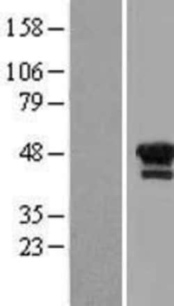 Novus Biologicals&trade;&nbsp;LIM1 Overexpression Lysate