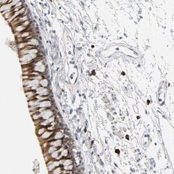 LIMCH1 Antibody, Novus Biologicals:Antibodies:Primary Antibodies