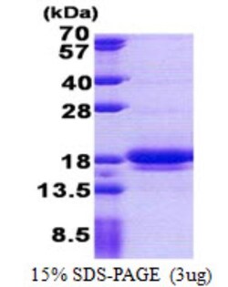 Novus Biologicals&trade;&nbsp;Recombinant Human LIMD2 His Protein