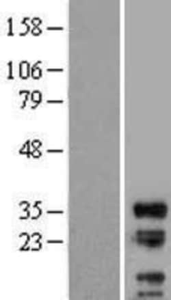 Novus Biologicals&trade;&nbsp;LIME Overexpression Lysate