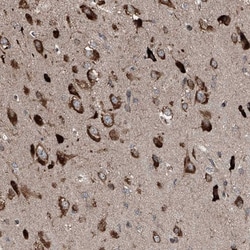LIM Kinase 1 Antibody, Novus Biologicals:Antibodies:Primary Antibodies