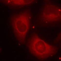 LIM kinase 2, p Thr505 Antibody, Novus Biologicals 0.025 mL; Unconjugated:Antibodies,