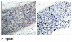 LIM kinase 2, p Thr505 Antibody, Novus Biologicals 0.025 mL; Unconjugated:Antibodies,
