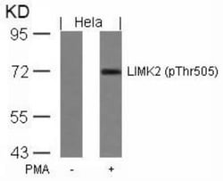LIM kinase 2, p Thr505 Antibody, Novus Biologicals 0.025 mL; Unconjugated:Antibodies,