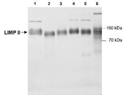 LIMPII/SR-B2 Antibody, Novus Biologicals:Antibodies:Primary Antibodies