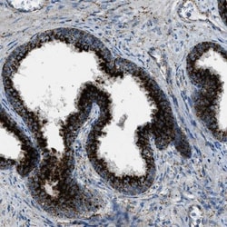 LIMPII/SR-B2 Antibody, Novus Biologicals:Antibodies:Primary Antibodies