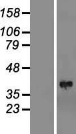 Novus Biologicals&trade;&nbsp;PINCH1/LIMS1 Overexpression Lysate