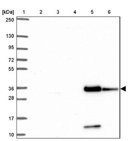 LIMS2 Antibody, Novus Biologicals 25 &mu;L, Unlabeled:Antibodies, Polyclonal