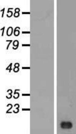 Novus Biologicals&trade;&nbsp;LIMS3 Overexpression Lysate