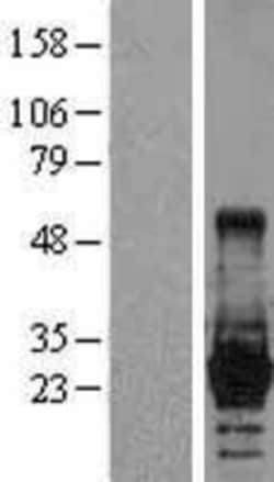 Novus Biologicals&trade;&nbsp;LIN-28A Overexpression Lysate