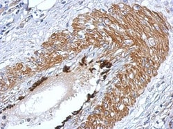 LIN-28A Antibody, Novus Biologicals 0.1mL; Unlabeled:Antibodies, Polyclonal