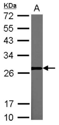 LIN-28A Antibody, Novus Biologicals 0.1mL; Unlabeled:Antibodies, Polyclonal