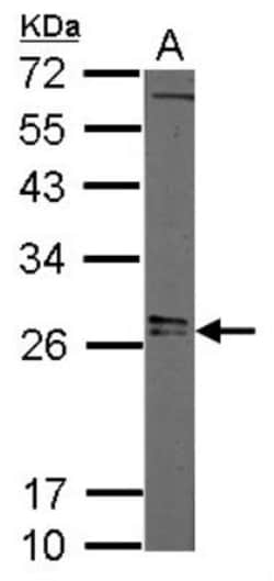 LIN-28A Antibody, Novus Biologicals 0.1mL; Unlabeled:Antibodies, Polyclonal