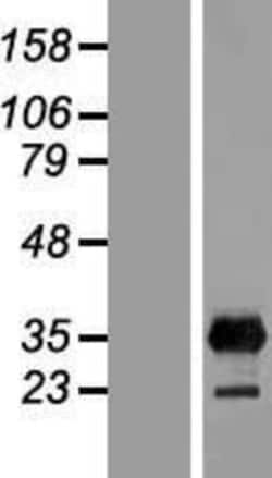Novus Biologicals&trade;&nbsp;LIN-28B Overexpression Lysate