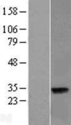 Novus Biologicals&trade;&nbsp;LIN37 Overexpression Lysate