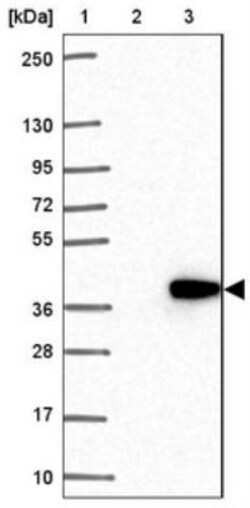 LIN37 Antibody, Novus Biologicals 0.1mL; Unlabeled:Antibodies, Polyclonal