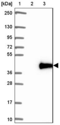 LIN37 Antibody, Novus Biologicals 0.1mL; Unlabeled:Antibodies, Polyclonal