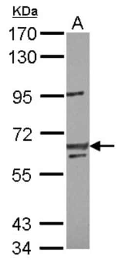lin-54 Antibody, Novus Biologicals 0.1mL; Unlabeled:Antibodies, Polyclonal