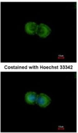 LIN7 Antibody, Novus Biologicals 0.1mL; Unlabeled:Antibodies