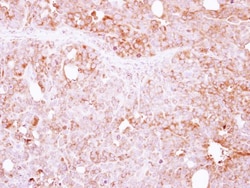 LIN7 Antibody, Novus Biologicals 0.1mL; Unlabeled:Antibodies