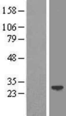 Novus Biologicals&trade;&nbsp;LIN7 Overexpression Lysate
