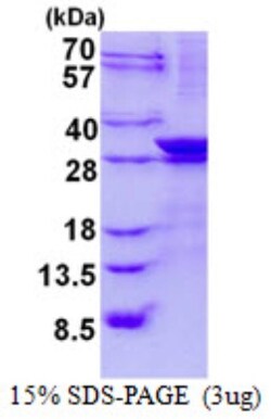 Novus Biologicals&trade;&nbsp;Recombinant Human LIN7 His Protein