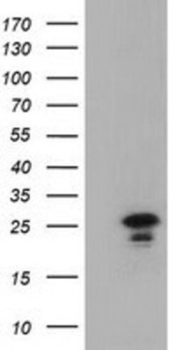 LIN7B Antibody (OTI1C9), Novus Biologicals 0.1mL; Unlabeled:Antibodies,