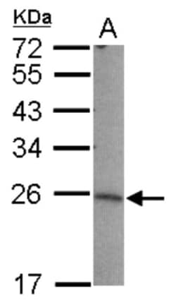 LIN7B Antibody, Novus Biologicals 0.1 mL | Buy Online | Novus Biologicals | Fisher Scientific