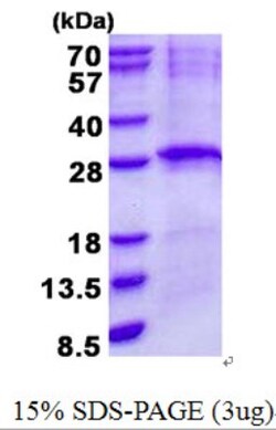 Novus Biologicals&trade;&nbsp;Recombinant Human LIN7B His Protein